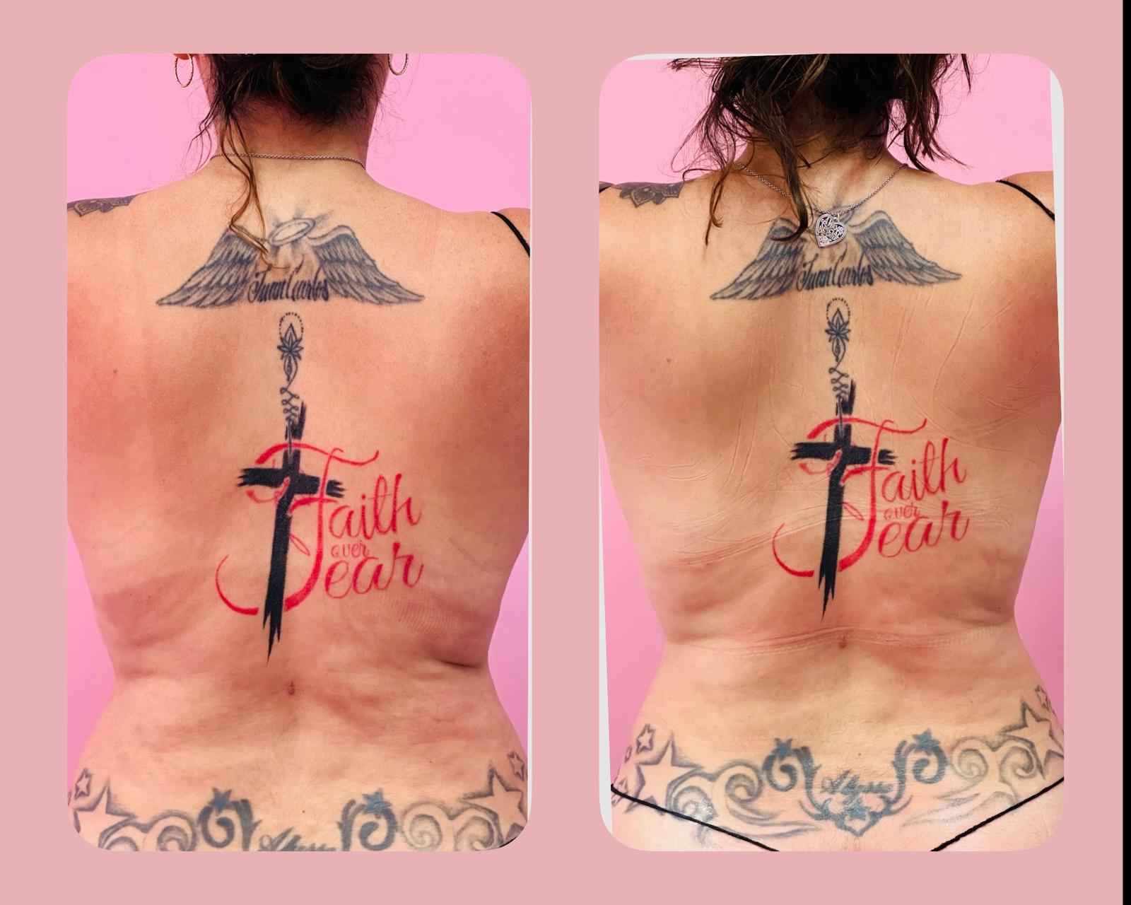 Body sculpting back view