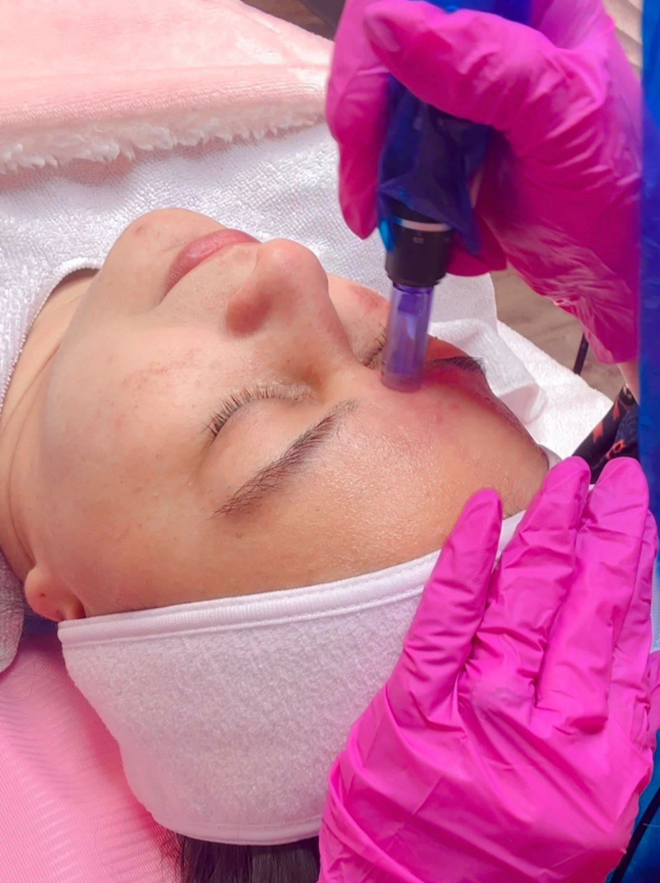 Facials